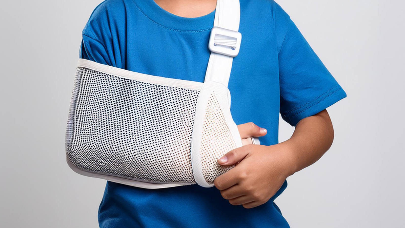 Fractures and Broken Bones