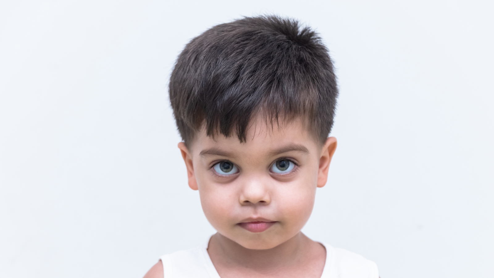 Squint (Strabismus)